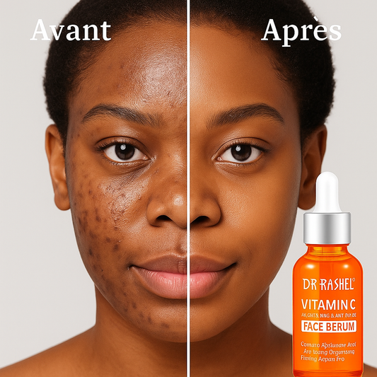Sérum Visage à la Vitamine C – DR.RASHEL
